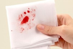 Effective recipes and ways to remove blood from clothes at home